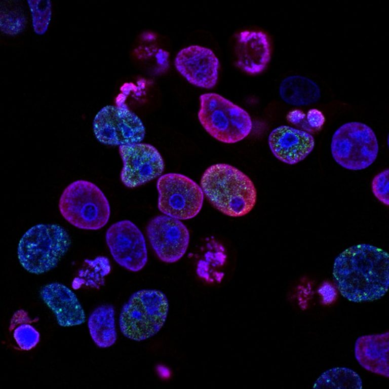 How Much Magnification Do You Need to See Cells